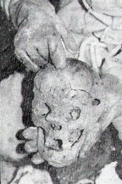 Једна од пронађених лобања у Шарановој јами са јасном повредом чеоне кости каква је настајала од ударца маљем