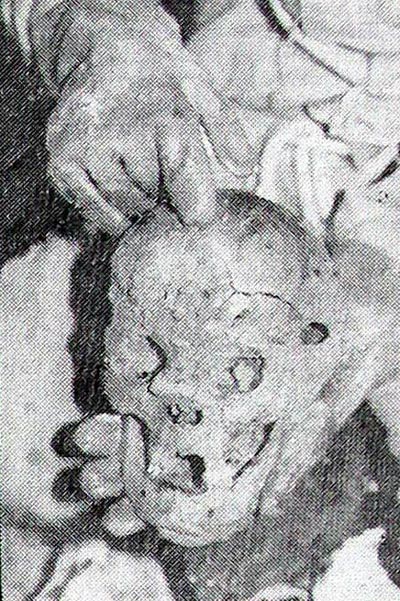 Једна од пронађених лобања у Шарановоj jами са jасном повредом чеоне кости каква jе настаjала од ударца маљем